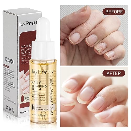 7 días de crecimiento y fortalecimiento de uñas suero 0.7 fl oz solución suavizante de onicomicosis aceite de tratamiento de uñas para uñas descoloridas y dañadas
