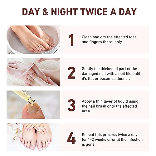 7 días de crecimiento y fortalecimiento de uñas suero 0.7 fl oz solución suavizante de onicomicosis aceite de tratamiento de uñas para uñas descoloridas y dañadas